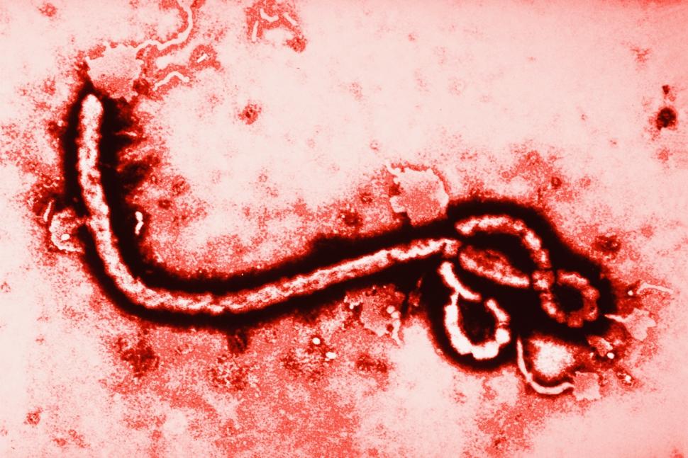 Read more about the article Ebola besmette patiënt heeft 10 dagen in Dallas rondgelopen