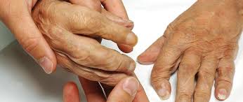 Read more about the article Bij Wereld Osteoporosedag: MDC constateert botontkalking bij 63% onderzochte personen