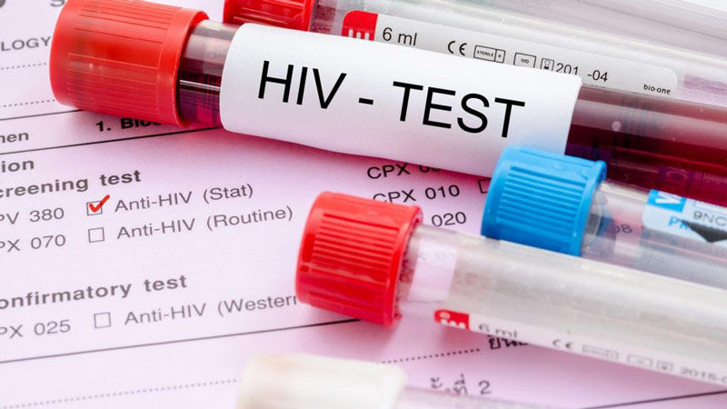 Read more about the article HIV nijpender door tekort aan materiaal en medicijnen