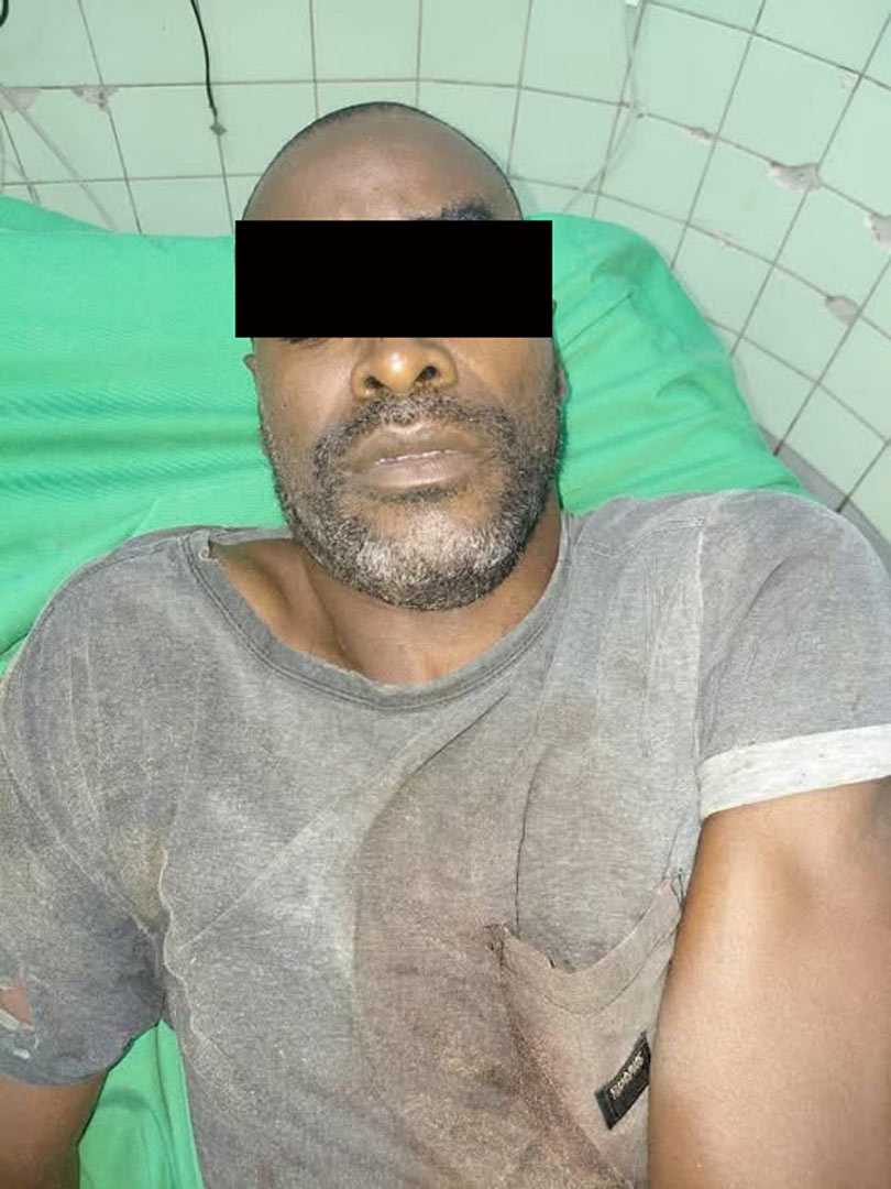 Read more about the article Verstikking door verhanging oorzaak dood Dennis Aroma