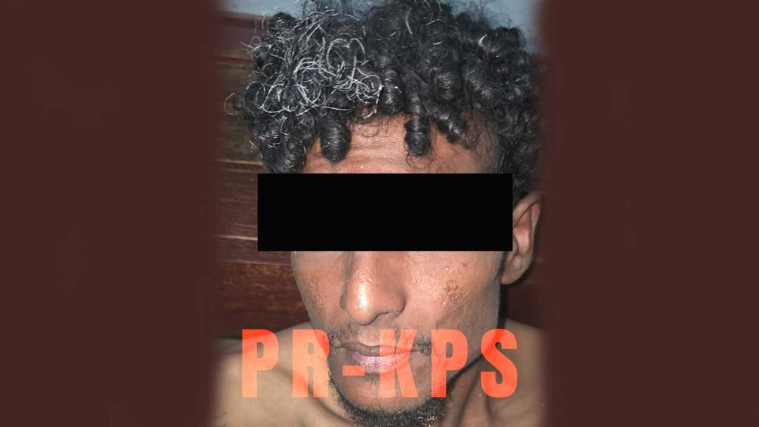 Read more about the article Diefstalverdachte in verzekering gesteld